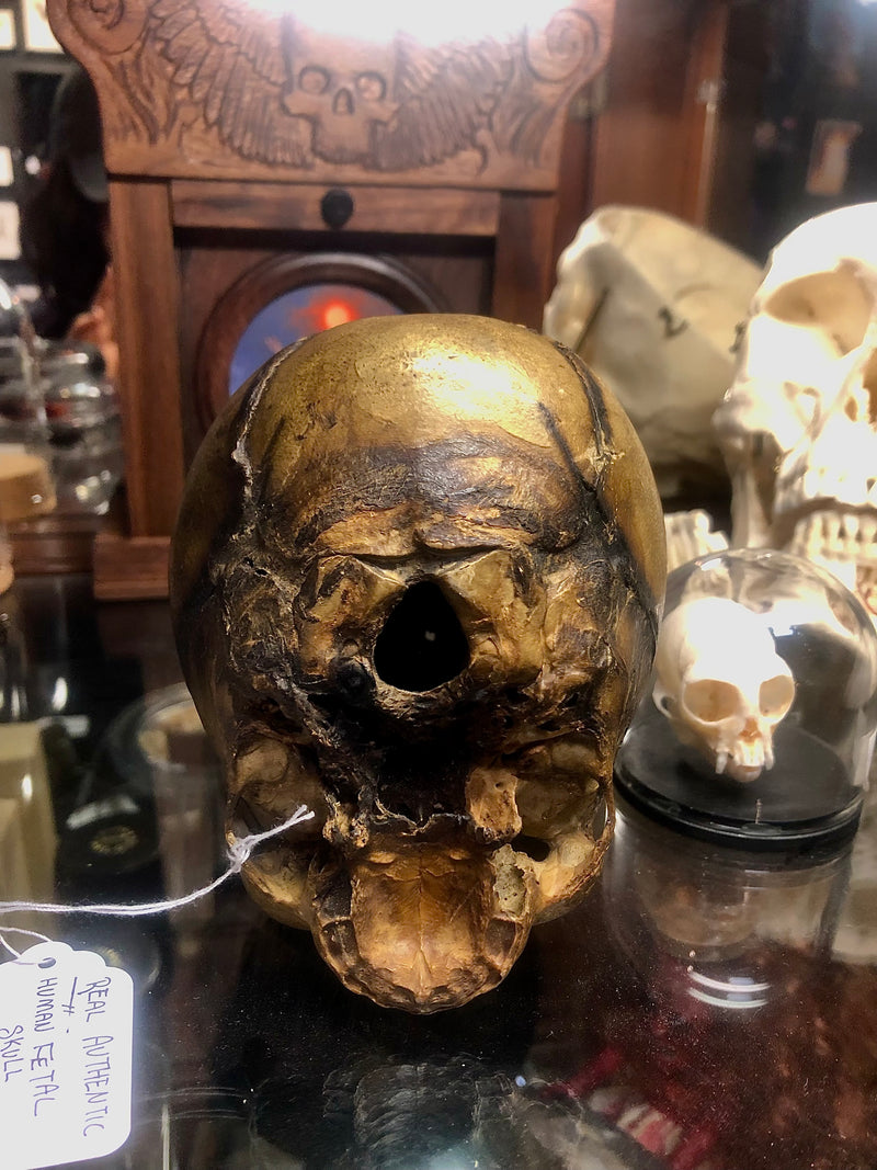 Authentic Fetal Skull