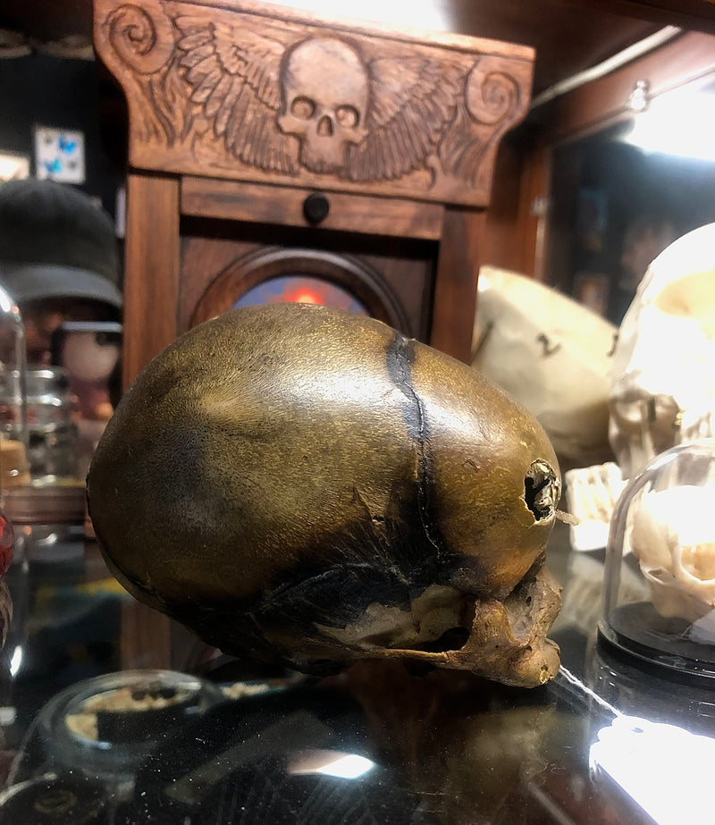 Authentic Fetal Skull