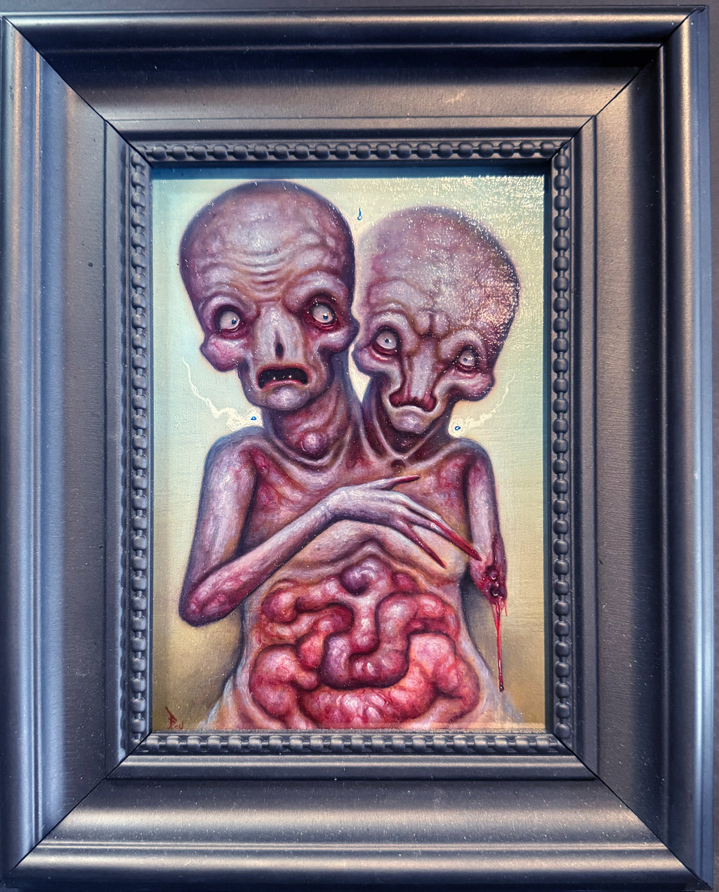 Conjoined
