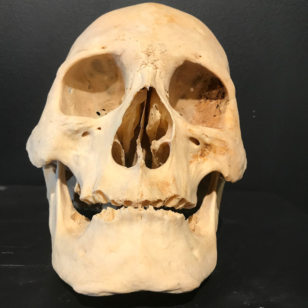 Authentic Human Skull
