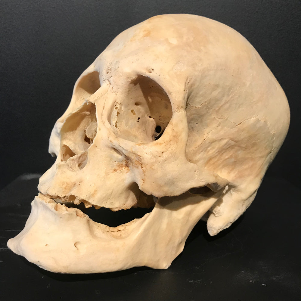 real human skull side view